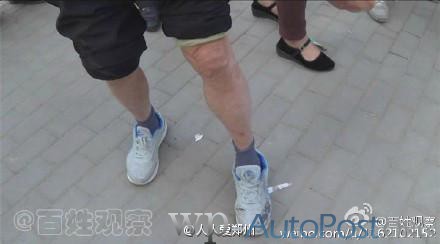 郑州一老汉称被出租车压伤脚 疑似碰瓷